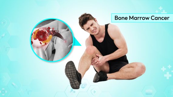 Bone Marrow Cancer Causes, Symptoms, and Treatment Options